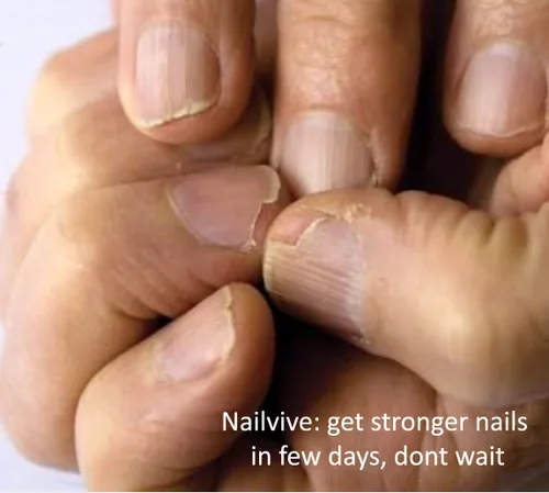 Vista 3 de NAILVIVE - Suero de uñas potentes proteínas de seda mágicas, fórmula natural probada que fortalece las uñas al instante evita que se rompan
