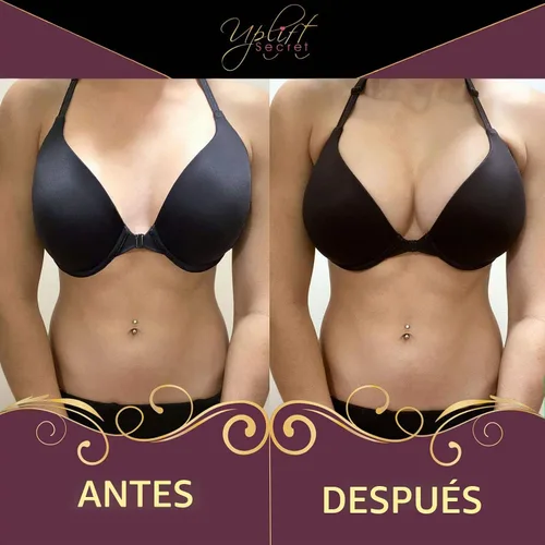 Vista 5 de Uplift Secret Inserciones de sujetador de silicona - Almohadillas de gel transparente para el pecho - Sujetador acolchado realzador de busto