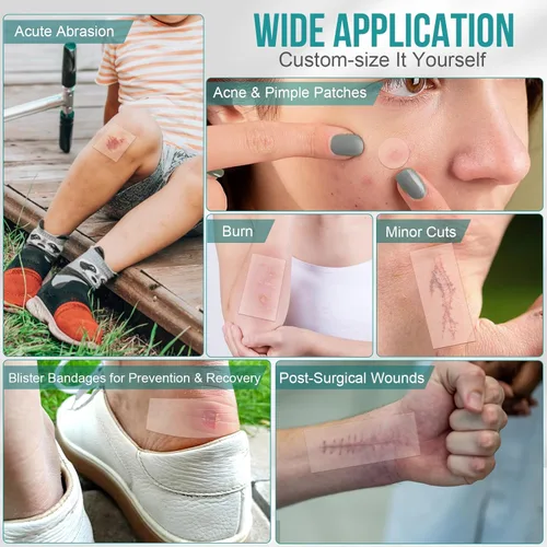 Vista 4 de Rollo hidrocoloide para el cuidado de heridas, vendajes de parche hidrocoloide con vendajes autoadhesivos, para úlceras de cama, altamente