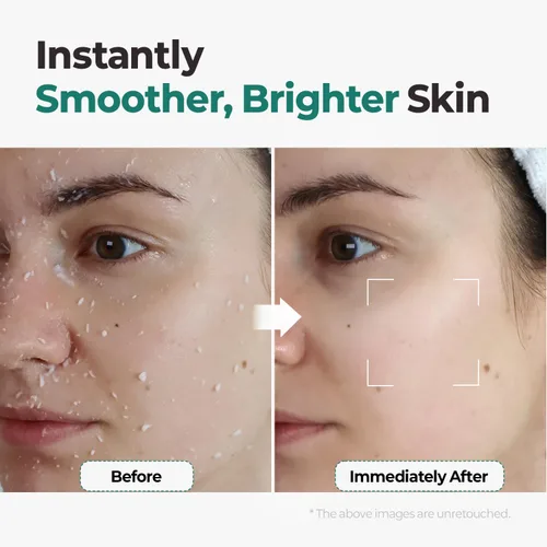 Vista 5 de MOTHER MADE Gel exfoliante facial vegano con té verde, vitamina E, ácido hialurónico, 3.38 onzas líquidas. Exfoliante facial suave y natural