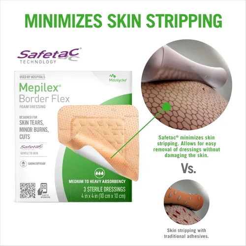 Vista 4 de Mepilex Border Flex 4 x 4 pulgadas (10 x 10 cm) Apósitos de Grado Hospitalario para Desgarros de Piel, Quemaduras Menores y Cortes, Adhesión