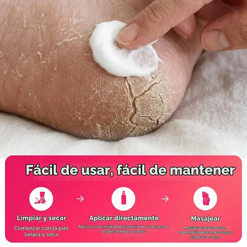 Vista 5 de FOOTLOGIX Fórmula para piel áspera con espiraleen, 4.23 oz
