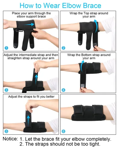 Vista 5 de Codera con 2 férula de metal extraíbles para dormir, soporte de túnel cubital ajustable con manga de compresión para codo de tenis, soporte