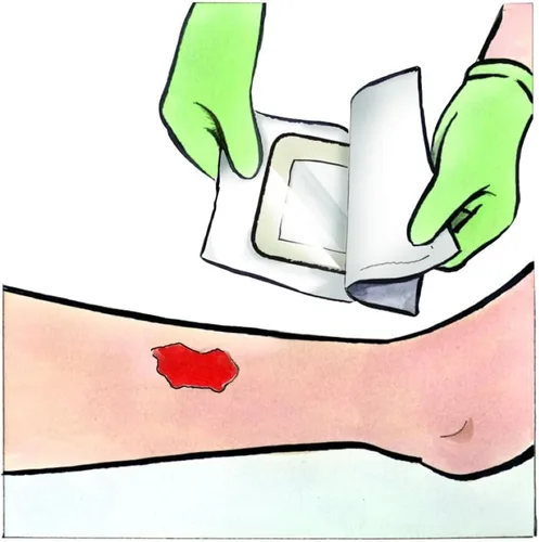 Vista 5 de Medline Stratasorb - Apósitos adhesivos impermeables para heridas, 4 x 4 pulgadas, caja de 10