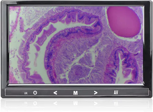 Vista 4 de 7" pantalla LCD de 5MP para tamaño de montaje del microscopio trinocular 76.1 ft m