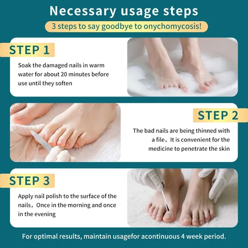 Vista 5 de Tratamiento de hongos en las uñas de los pies, tratamiento de hongos en las uñas extra fuerte para uñas, amarillas, decoloradas, uñas rotas
