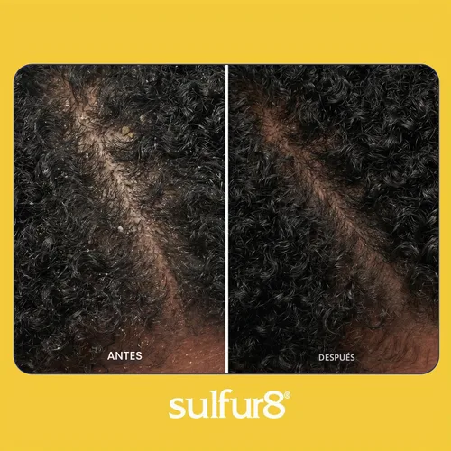 Vista 4 de Acondicionador Sulfur8 medicado regular, fórmula anticaspa para cabello y cuero cabelludo, 2 oz, paquete de de 1