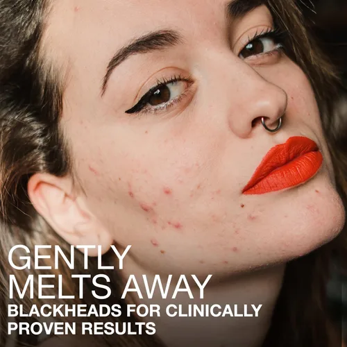 Vista 4 de Neutrogena Stubborn Blackheads - Suero facial diario para acné con ácidos salicílico, glicólico, polihidroxi y mandélico, suero facial sin aceite