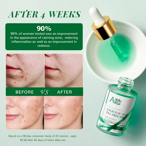Vista 5 de ANAI RUI Aceite facial para acné, aceite de árbol de té con ácido salicílico, aceite de piel propensa al acné, alivia el acné, alivio