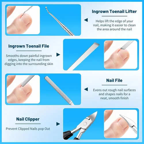 Vista 6 de SelfTek Kit de uñas encarnadas – Kit profesional de corrector de uñas encarnadas con tiras transpirables y parches curvos, lima sin dolor