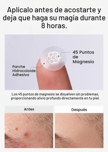Vista 5 de EasyDerm Quick Microdart - Parche para espinillas de magnesio 10ea Calmante rápido