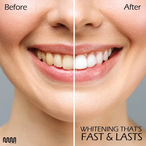 Vista 5 de MasterMedi Tiras blanqueadoras dentales, tira blanca no sensible para blanquear los dientes, 14 tratamientos