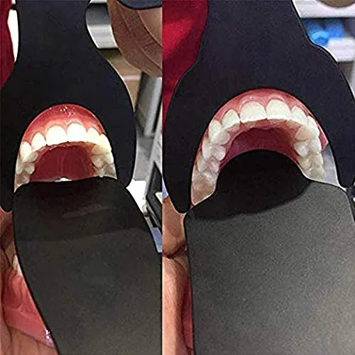 Vista 6 de 6 unids foto dental contraste negro fondo tablero intraoral ortodoncia fotografía contraste palatal fotografía contraste contraste