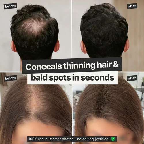Vista 3 de IMPERIO Fibras de construcción del cabello para adelgazar el cabello, 0.92 oz de fibras capilares de primera calidad para mujeres y hombres