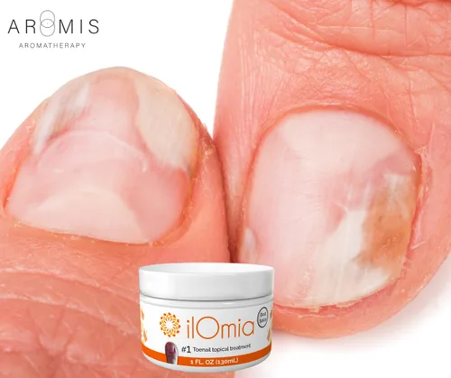 Vista 6 de Crema natural para hongos en las uñas de los pies - Para uñas dañadas, agrietadas, amarillentas y descoloridas - Botella de 1 onza - Fabricado