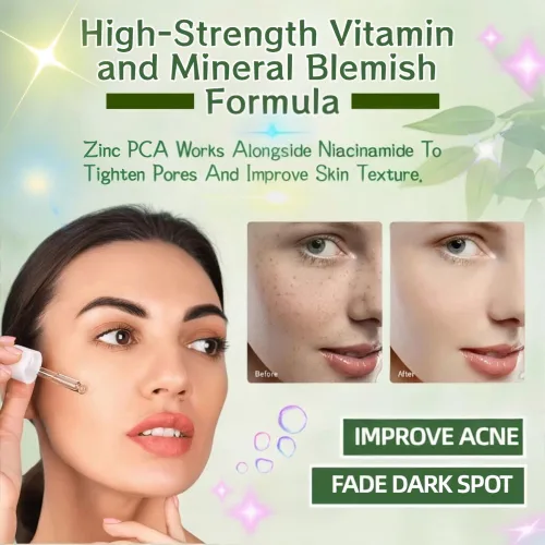 Vista 2 de Suero de niacinamida 10% + zinc 1% para la cara – Control de aceite, acné, minimizador de poros y reducción de manchas – Suero facial ligero