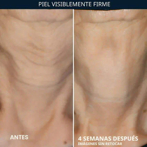 Vista 6 de RoC Crepe Repair Crema hidratante facial diaria antienvejecimiento y crema reafirmante para el cuello (1.7 onzas) + cápsulas suavizantes RoC Retinol