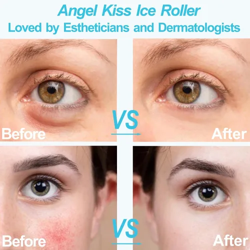 Vista 5 de Angel Kiss Rodillo de hielo para ojos faciales, idea de regalo para mujeres, masajeador de terapia de frío para reducir la hinchazón
