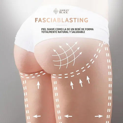 Vista 8 de Fasciablaster