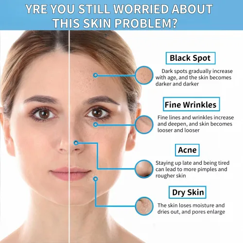 Vista 4 de Niacinamida 10% + Zinc 1% suero para la cara – Control de aceite, acné, reductor de poros y reducción de imperfecciones – Suero facial ligero,