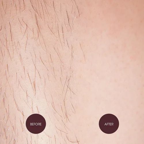 Vista 7 de Nad's Waxing Dots - Cuentas de cera dura de fresas y crema, fórmula sin tiras para microondas para mujeres