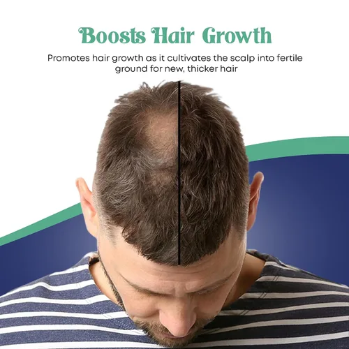 Vista 8 de Genuine African Formula Champú Let-It-Grow 16oz
