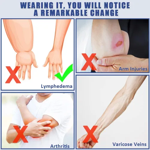 Vista 6 de beister Manga de compresión médica para el brazo para linfedema con guante para hombres y mujeres (individual), soporte completo de brazo de 20-30