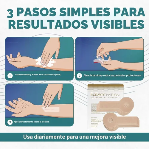 Vista 7 de EpiDerm Areopexy - Cinta de silicona para cicatrices, con forma de piruleta, natural, 5 pares
