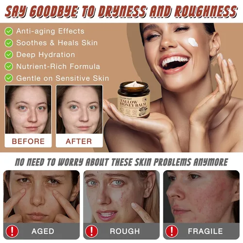 Vista 3 de GOGIFTGO Sarga de ternera para la piel, sebo y bálsamo de miel, sarga de res para la cara, hidratante facial de caldo, hidratante natural hidrata
