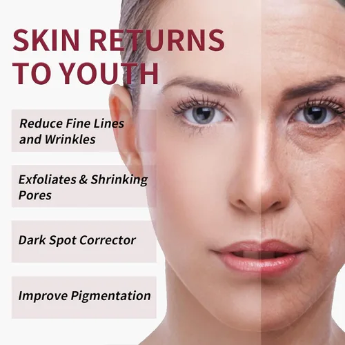 Vista 4 de AHA 30% + BHA 2% Solución de exfoliación química exfoliante para la piel en el hogar, máscara facial de pelado rojo, BHA, líquido exfoliante ácido