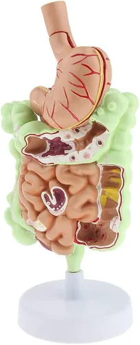 Vista 3 de KESOTO Modelo de Patología Gastrointestinal Humana Modelo Coronal Gástrico del Tracto Digestivo para Estudiantes Escolares Aprendizaje