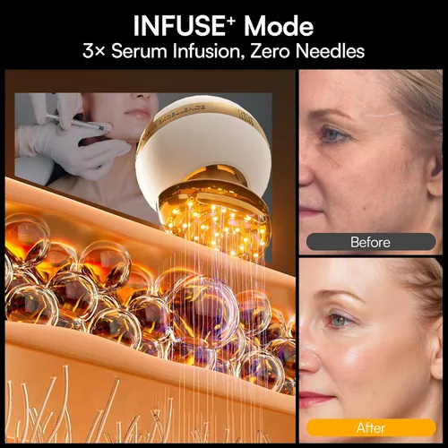 Vista 7 de INIA SPHERA - Dispositivo facial de microcorriente 8 en 1 mejorado