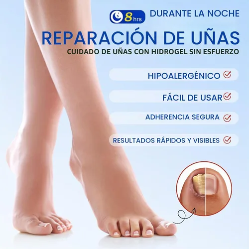 Vista 4 de Parches de uñas para uñas de los pies, 21 parches de cuidado de uñas de hidrogel, soporte y protección de uñas durante la noche, fácil de aplicar
