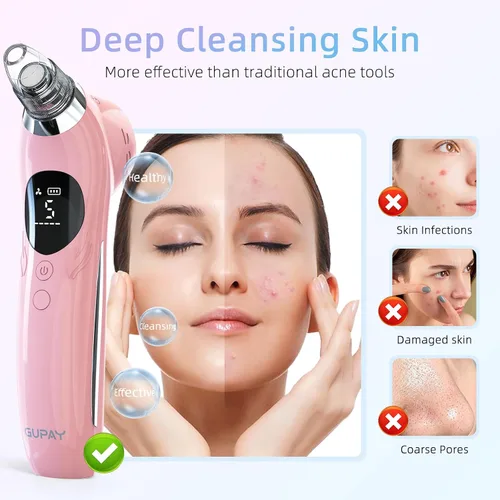 Vista 3 de Removedor de puntos negros, aspiradora facial, limpiador de poros eléctricos, comedones, 5 sondas de succión y 5 niveles de succión, herramientas
