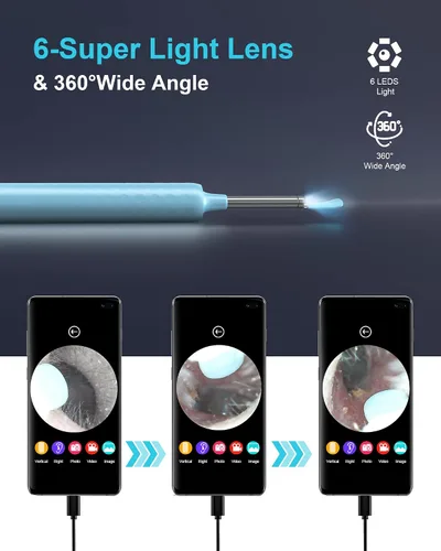 Vista 5 de DJROLL Eliminación de cera de oído, herramienta de eliminación de cerumen, cámara de oído, visor de oído con herramienta limpiadora de cera de oído