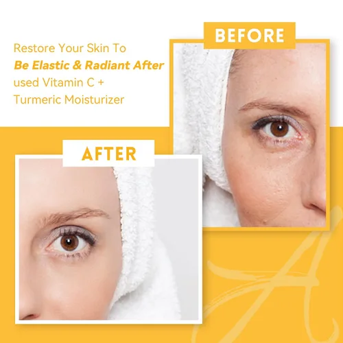 Vista 4 de ANAI RUI Crema facial de cúrcuma con vitamina C, 1.76 onzas Hidratante facial para hidratar, reafirmar, tensar la piel, crema de cúrcuma