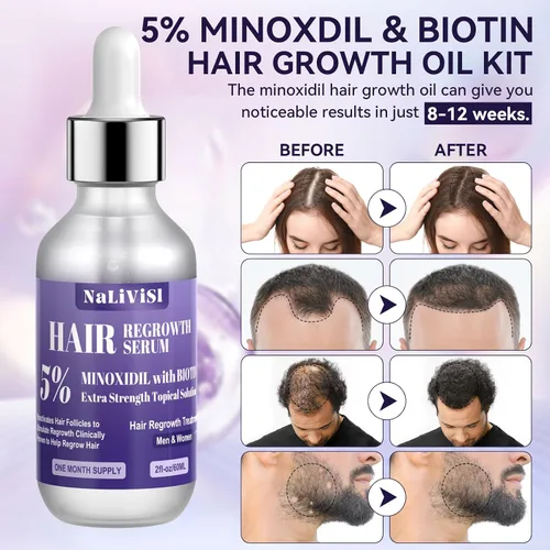 Vista 7 de Paquete de 2 aceites de minoxidil al 5% para hombres y mujeres, suero de crecimiento del cabello con masajeador del cuero cabelludo, espuma