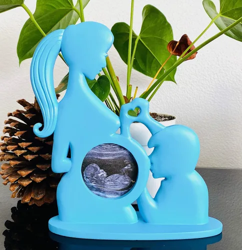 Vista 2 de Marco de fotos de ultrasonido, marcos de ecografía, regalos imprescindibles para el embarazo para futuros padres, anuncios de bebé, decoración