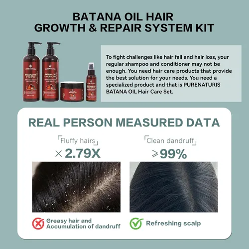 Vista 4 de Kit Completo de Crecimiento Capilar 100% Natural Crudo Orgánico de Aceite de Batana Sin Sulfatos, Sistema Anti-Caída y Reparador – Champú