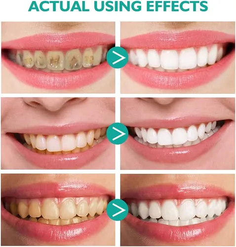 Vista 8 de Pasta de dientes de espuma, 2 unidades, pasta de dientes para eliminar manchas para dientes sensibles, blanqueamiento de espuma de dientes