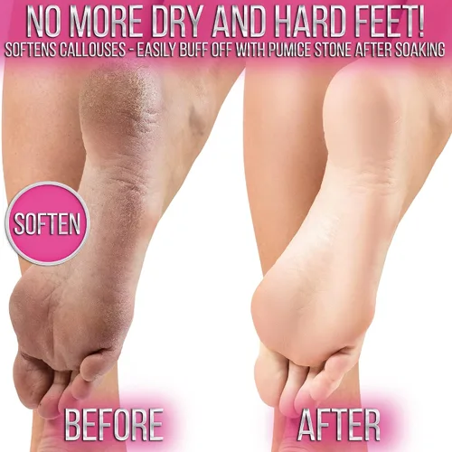 Vista 3 de Crafts And The City SOO Jelly - Paquetes de pedicura para pies - Gel de pedicura para pies - Gel de pedicura para pies - Gel de pedicura para pies