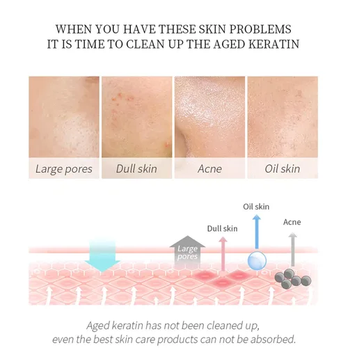 Vista 2 de Gel exfoliante de manzanilla de limpieza profunda de poros encogimiento de poros exfoliación suave apretar, hidratar, hidratar, reparar, suavizar