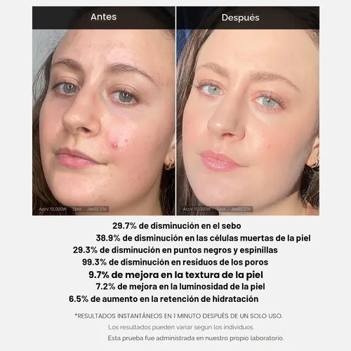 Vista 4 de Medicube Exfoliante ácido al 21% para enjuagar (AHA+BHA+ácido succínico), suero renovador para enjuagar, mejor para pieles irregulares y propensas a
