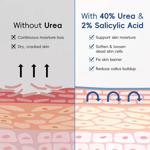 Vista 6 de Paquete de 2 crema de urea 40% + 2% ácido salicílico, 3.53 onzas, hidratante de máxima fuerza para pies y manos para piel áspera y seca, removedor