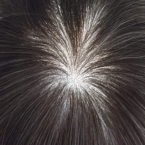 Vista 7 de Toupee para hombres Unidad de cabello para hombre, piezas de cabello humano europeo, 0.002 in, piel ultra fina, sistemas de reemplazo de cabello