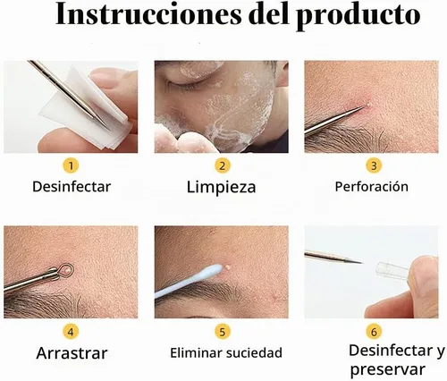 Vista 7 de Kit de herramientas para eliminar espinillas, 4 piezas, herramienta extractor de espinillas para nariz y cara, juego de herramientas de eliminación