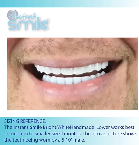 Vista 3 de Instant Smile Chapa inferior blanca brillante hecha a mano