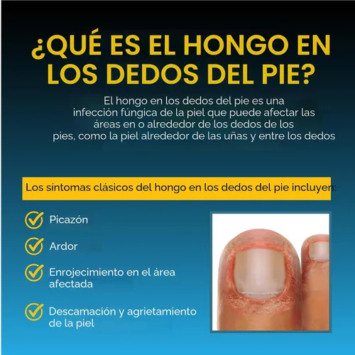 Vista 5 de Fungi-Nail Aplicador en Pluma Solución Antifúngica, Mata los Hongos que Pueden Causar Infecciones en las Uñas y Pie de Atleta con Tolnaftato