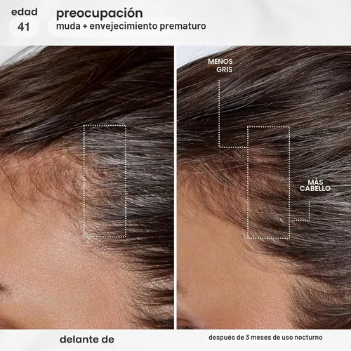 Vista 3 de K18 FutureIQ Biomimetic Longevity Hair + Scalp Serum, 3.04 oz