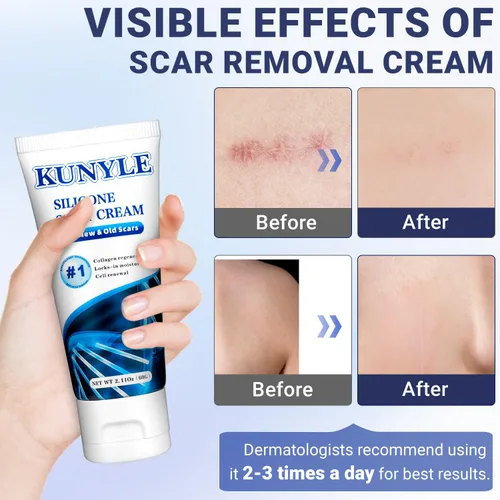 Vista 2 de Crema Cicatricial, Gel de Silicona para Cicatrices, Crema Avanzada para Eliminar Cicatrices Quirúrgicas, Eliminación de Estrías, Eliminación